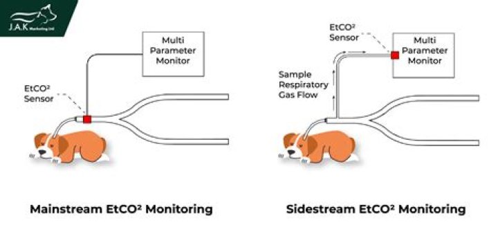 Spotilocal vs. Mainstream Streamers: Why Local Control Wins